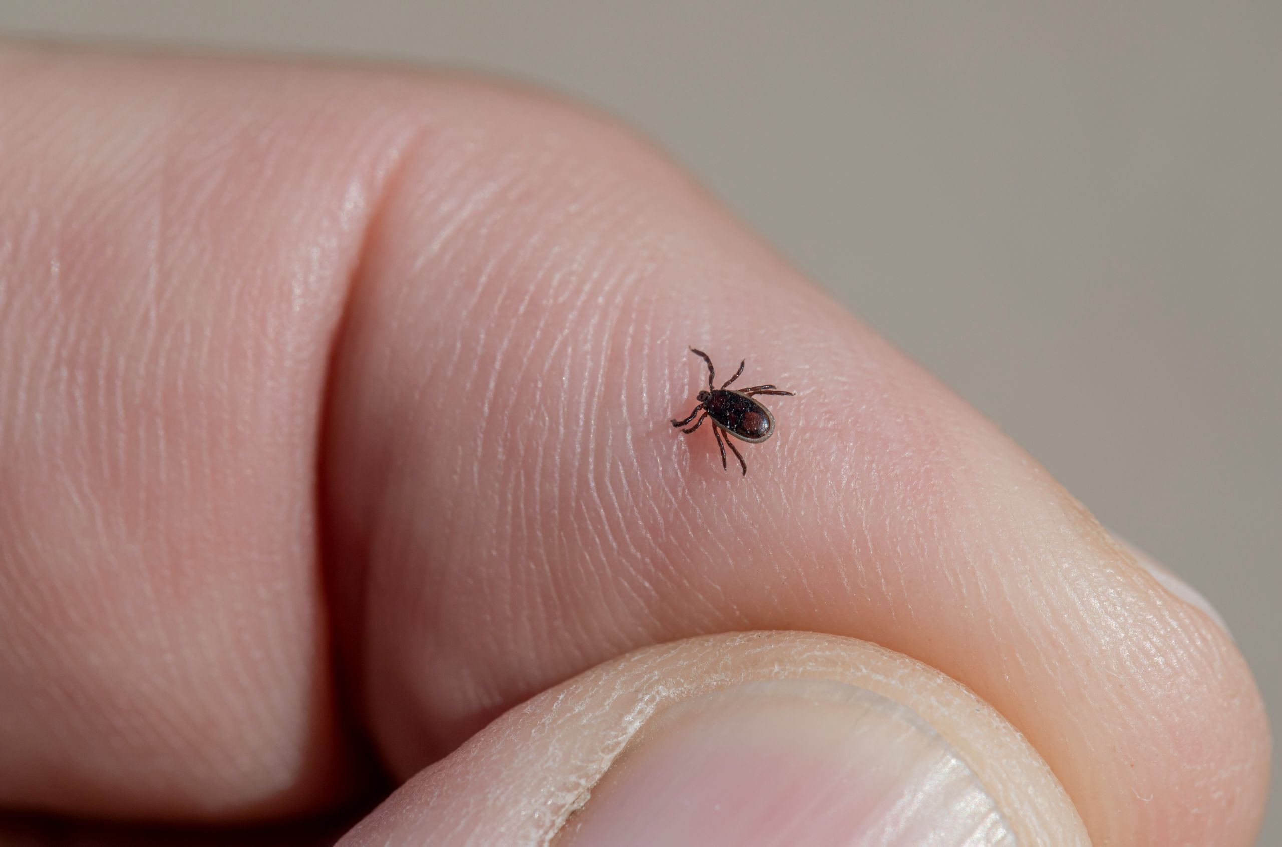 A close-up of a small black tick crawling on the skin of a person’s finger, with skin texture and a fingernail clearly visible, highlights the minute details often associated with ticks.