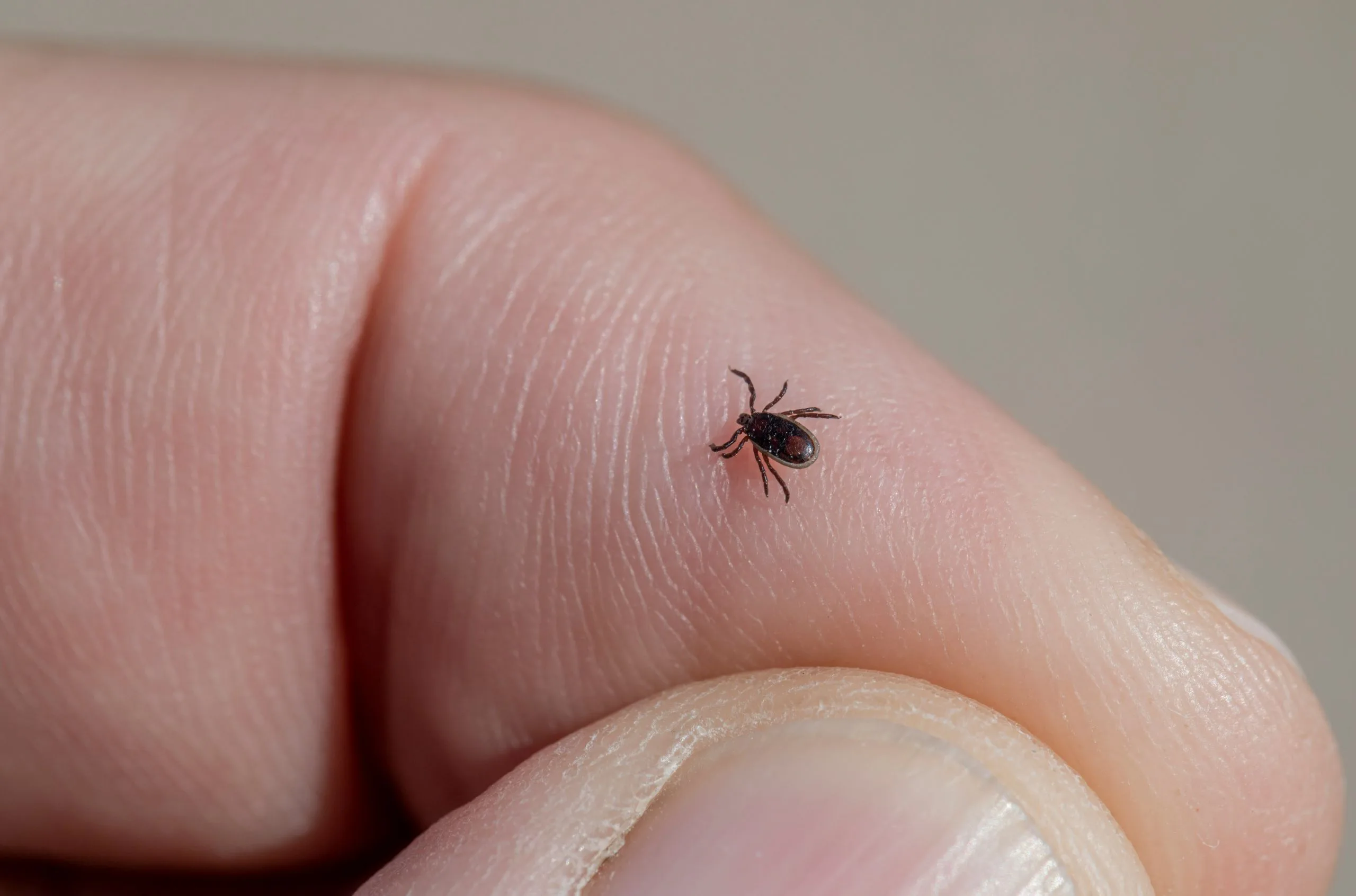 ticks A close-up of a small black tick crawling on the skin of a person’s finger, with skin texture and a fingernail clearly visible, highlights the minute details often associated with ticks.